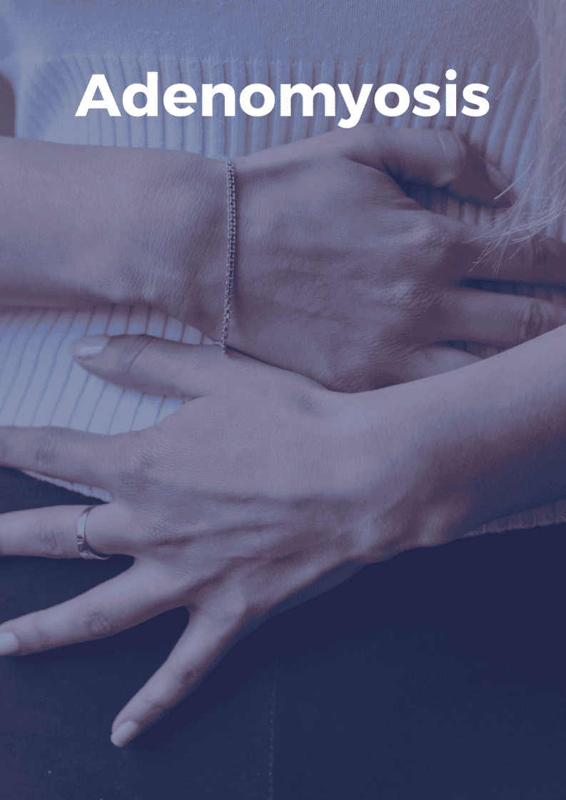 Adenomyosis treatment