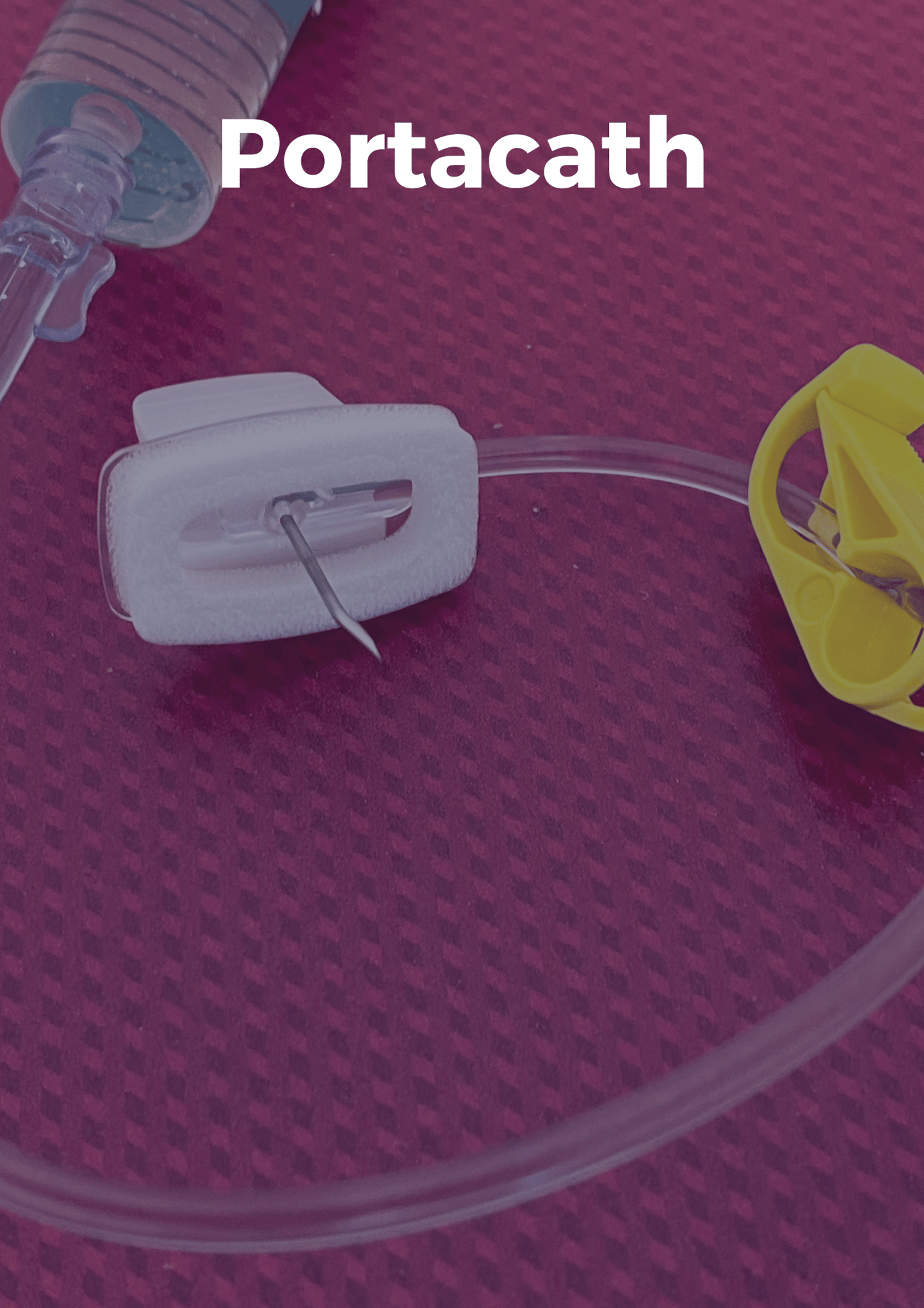 Treatment images - vertical-1