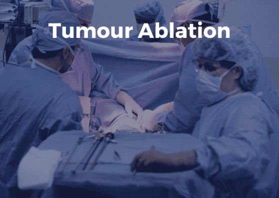 Tumour ablation