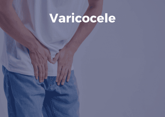 Varicocele treatment