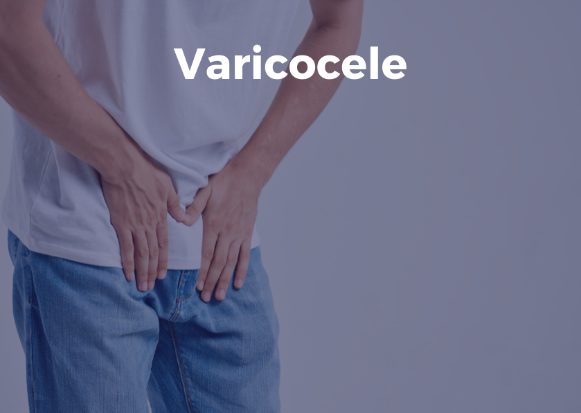 Varicocele