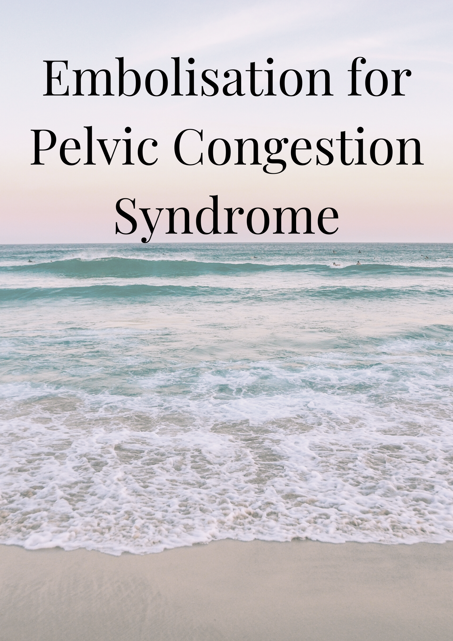 Embolisation for Pelvic Congestion Syndrome