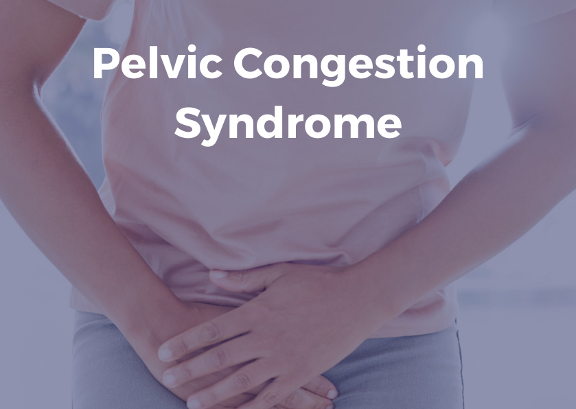 Pelvic congestion syndrome