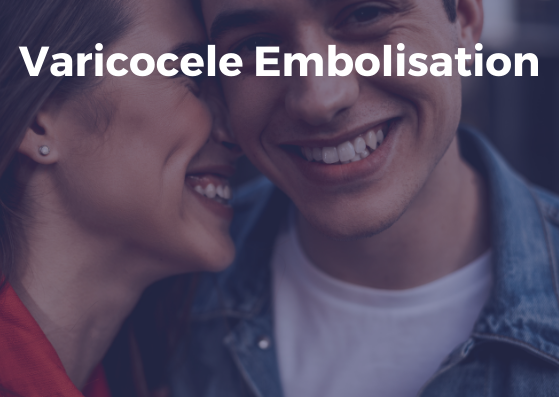 Embolisation for varicocele