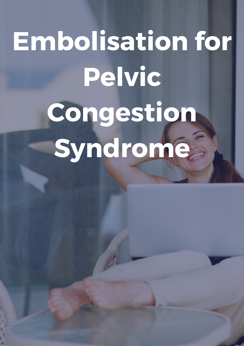 Embolisation for Pelvic Congestion Syndrome